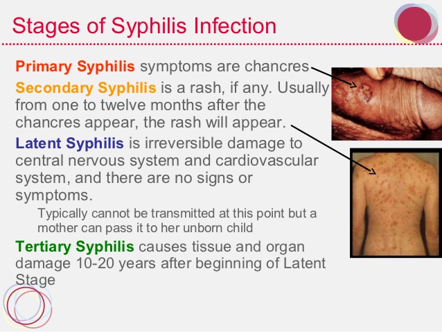 Syphilis - Sexually Transmitted Diseases-9847