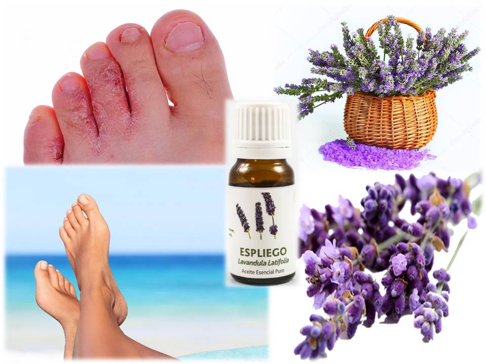 AROMATERAPIA, SALUD Y MAGIA COMO TRATAR EL PIE DE ATLETA DE MANERA NATURAL