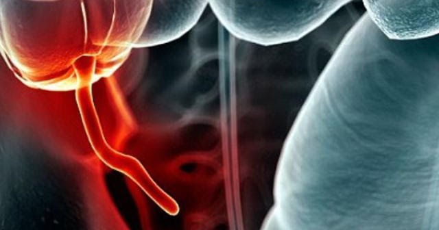 Apa yang Disebut Usus Buntu? | Belajar Sampai Mati