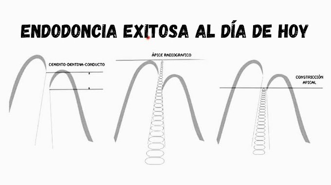 WEBINAR: La Endodoncia Exitosa al día de hoy - Dr. Mauricio González del Castillo Silva