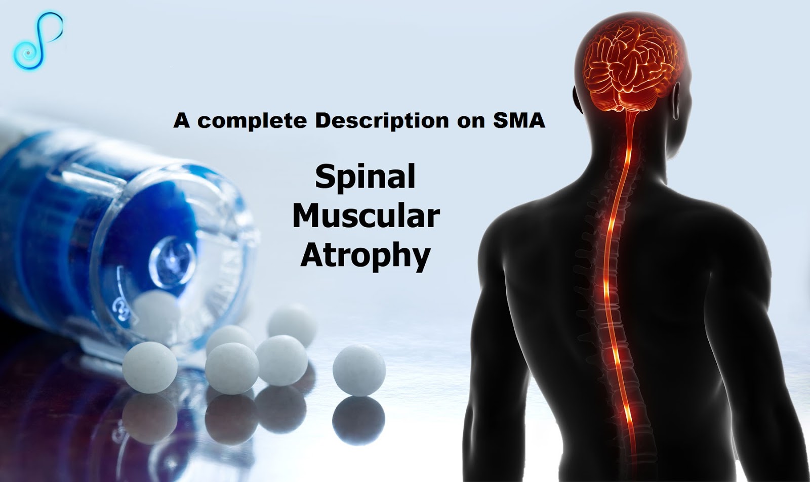 What Actually Spinal Muscular Atrophy Is SMA SMA Families sma-spinal-muscular-atrophy-in-babies-causes-and-treatment