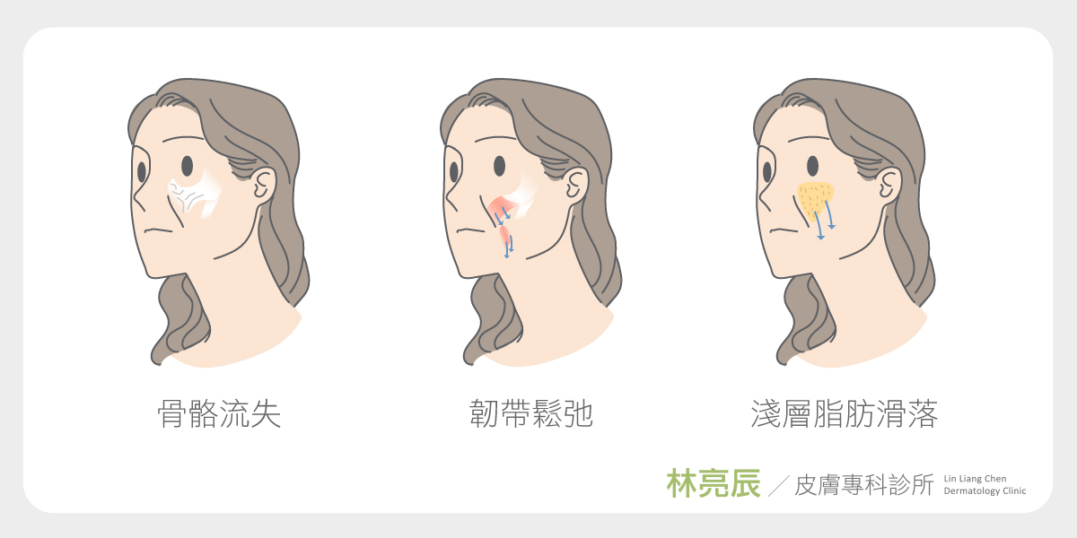02-【法令紋醫美】為什麼法令紋沒有補滿,但是法令紋卻變淺了 法令紋醫美ptt新竹推薦醫美醫師玻尿酸法令紋dcard法令紋肉毒法令紋消除舒顏萃童顏針3D聚左旋乳酸林亮辰皮膚專科診所林亮辰醫師