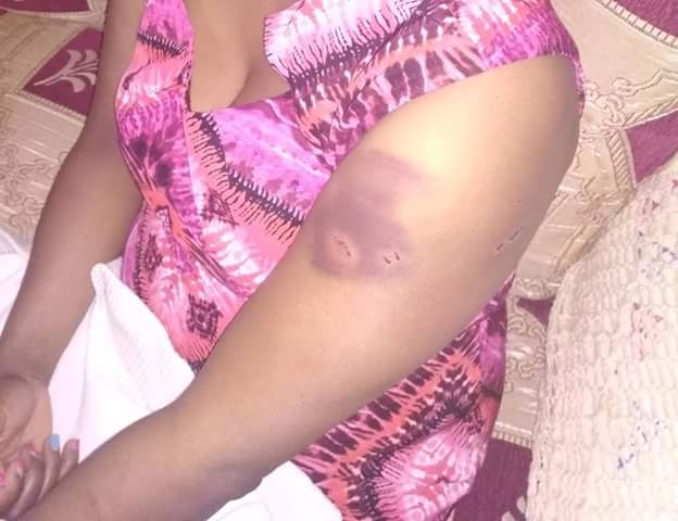 Photos: Kenyan lawmaker accused of assaulting his wife after she accused him of infidelity and infecting her with STD 