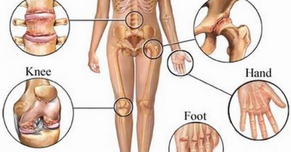 Natural Remedies For Kidney Stones During Pregnancy Natural Remedies For Kidney Stones During Pregnancy