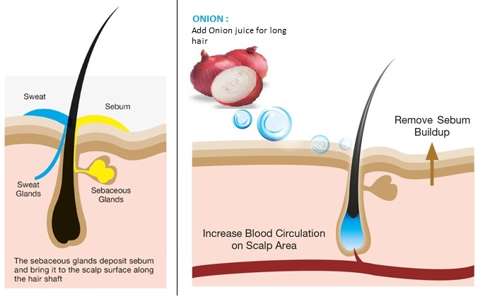 onion for hair growth