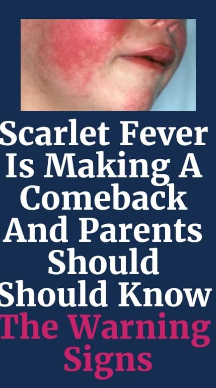 Scarlet Fever Is Making A Comeback And Parents Should Should Know The