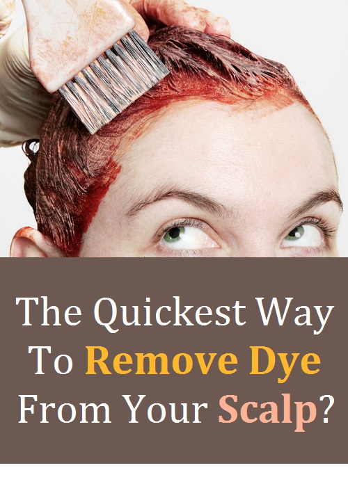 the-quickest-way-to-remove-dye-from-scalp-charlotte-moore