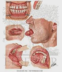 sipilis obat sipilis manjur