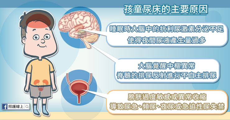 孩童尿床主要原因