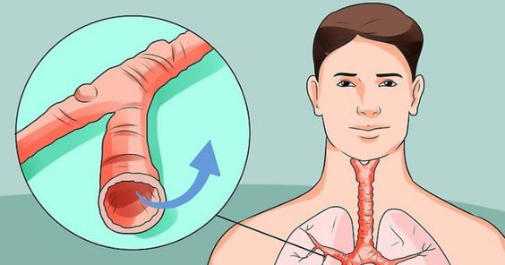 How to Get Rid of Excess Phlegm in Your Throat - Sweet Oh Joy