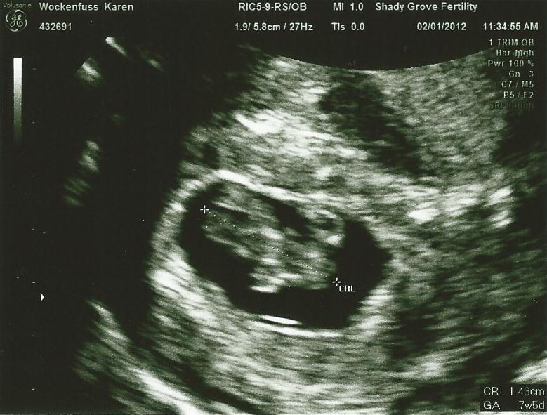 My Peanut and me 8 Weeks