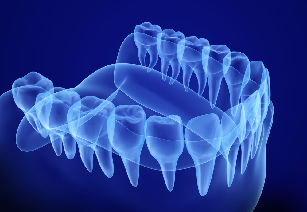 Go For The Best 3d Dental Scan