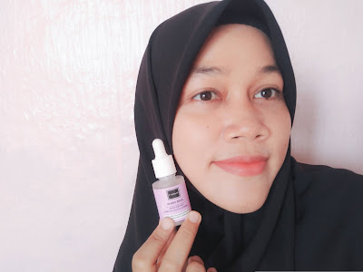 berpose dengan serum scarlett brightly