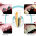 Cấy ghép răng Implant thay thế một răng cần chú ý