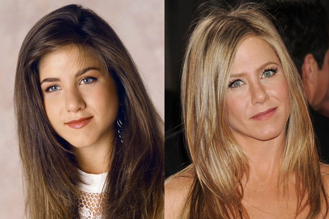 Jennifer Aniston Plastic Surgery : Jennifer Aniston Plastic Surgery Before and After