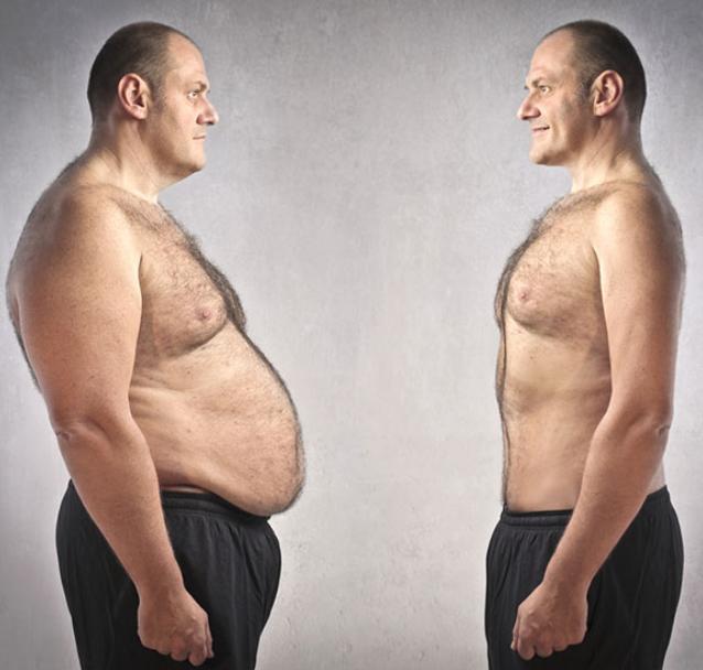 أسعار عمليات شفط الدهون بمصر