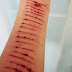 Σοκ: 12χρονη χαρακώθηκε με ξυράφι “υπακούοντας” σε εντολές μέσω chat - Την πρόλαβαν πριν πάρει χάπια