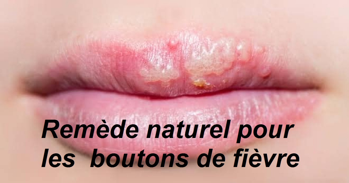 Faire Lamour Avec Un Bouton De Fièvre Bouton de fièvre : Remède naturel efficace et rapide ~ Sport et Santé