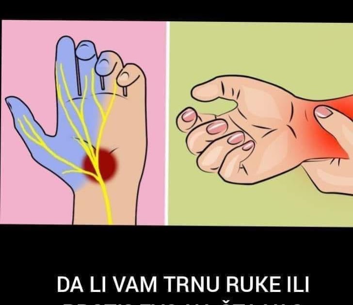 DA LI VAM TRNU RUKE ILI PRSTI? EVO NA ŠTA VAS UPOZORAVA OVAJ SIMPTOM ...