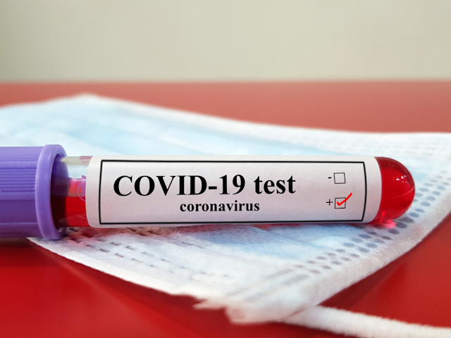 المهدية : تسجيل 119 إصابة جديدة و 6 وفيات بفيروس كورونا