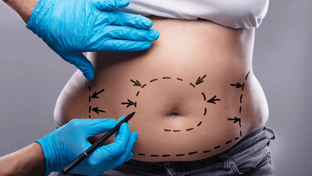 4 Different Types Of Liposuction Available Today Written By Barbies Beauty Bits