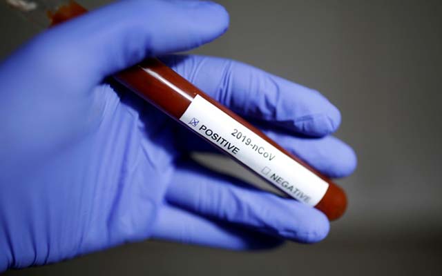 Bahia registra 127 casos confirmados de coronavírus; 17 estão curadas