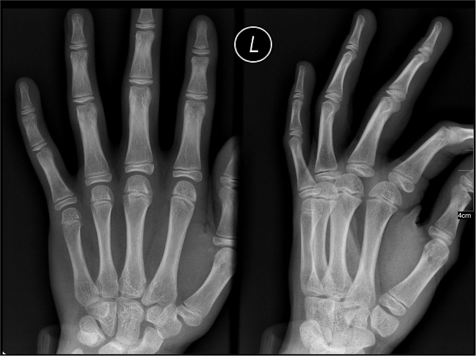 Medical Xrays Radiological Imaging From Film to Digital Xrays
