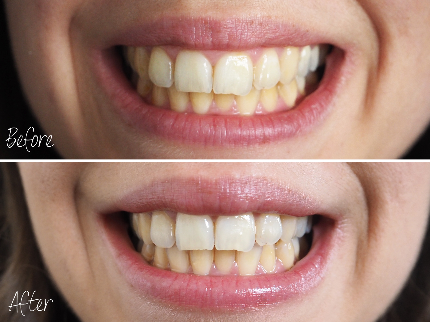 Sweet Monday UK Fashion and Lifestyle Blog Beauty // Mr Blanc teeth