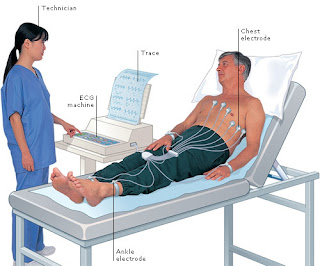 pemasangan EKG
