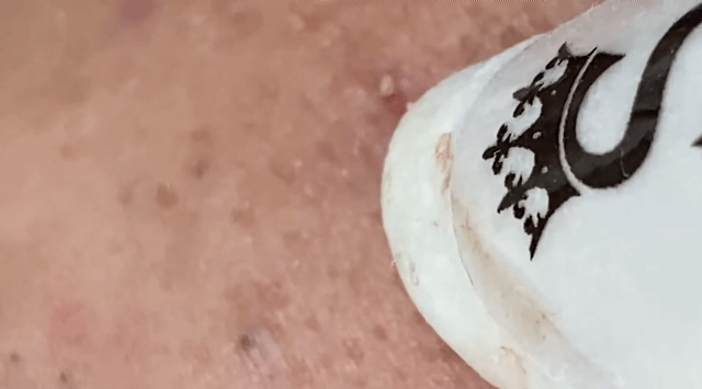 99e5c71160fbae0e70b08ea169ce4c457b637d8b