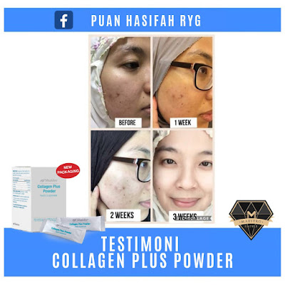 Promosi Collagen Shaklee 2019 Jualan Kilat