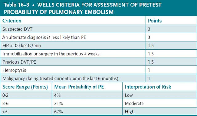 wells criteria for assessment of pretest probability of pulmonary embolism