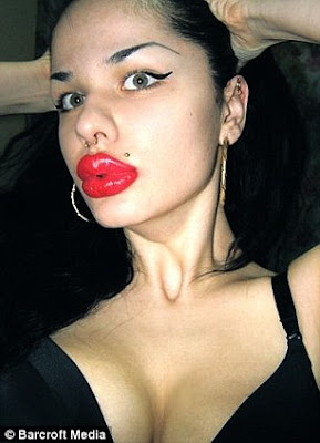Woman desperate to look like Jessica Rabbit gets world's biggest lips after 100 injections (and she's not stopping there) 11