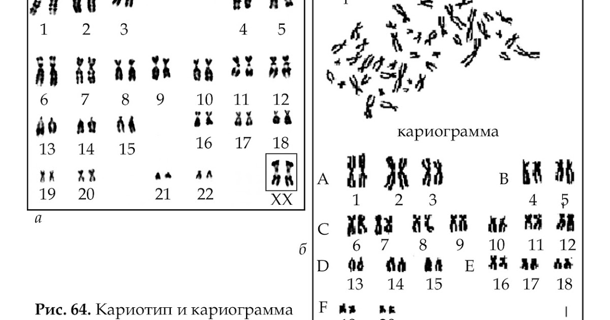 Кариотип собаки включает 78 хромосом определите. Кариограмма хромосом человека. кариограмма и идиограмма. идиограмма кариотипа человека. нормальная кариограмма хромосом человека.