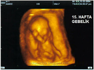 hamileliğin 15. haftasında ultrasound