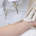 Xóa xăm bằng laser liệu có an toàn ?
