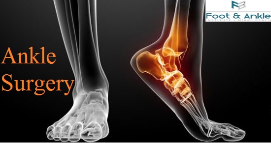 Foot and Ankle Surgery Miami