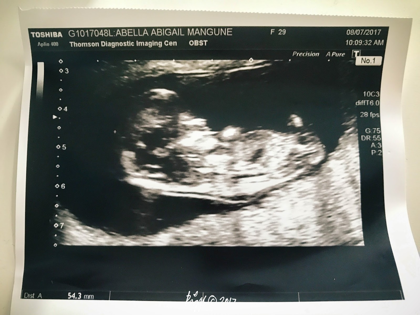 LITTLE PICKLE'S JOURNEY FIRST TRIMESTER WEEK 10 TO WEEK 12 (3 MONTHS