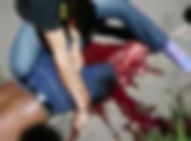 VEJA VÍDEO – Motoqueiro de 27 anos que caiu da ponte precisou amputar a perna