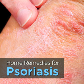 psoriasis causes in urdu