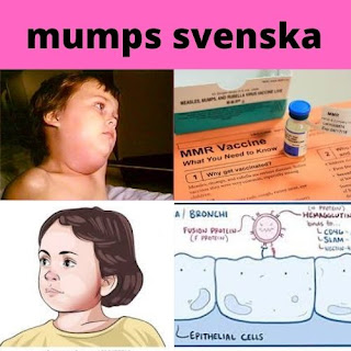 mumps svenska