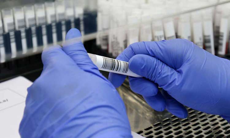 Bahia registra 1.811 novos casos de Covid-19 em 24h