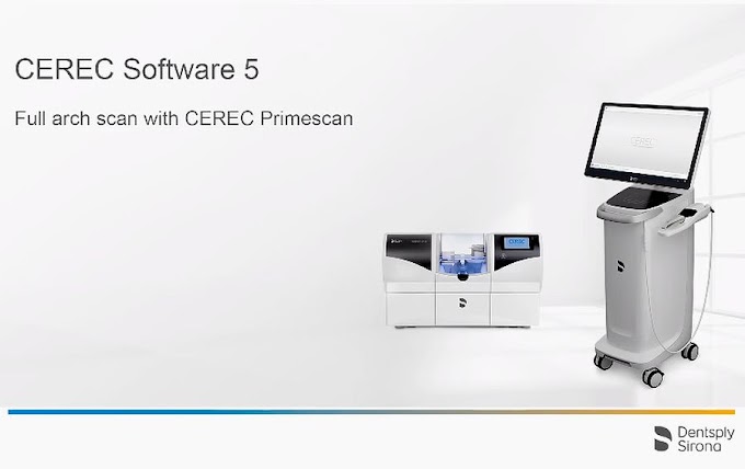 CEREC Software 5: Full arch scan with CEREC Primescan