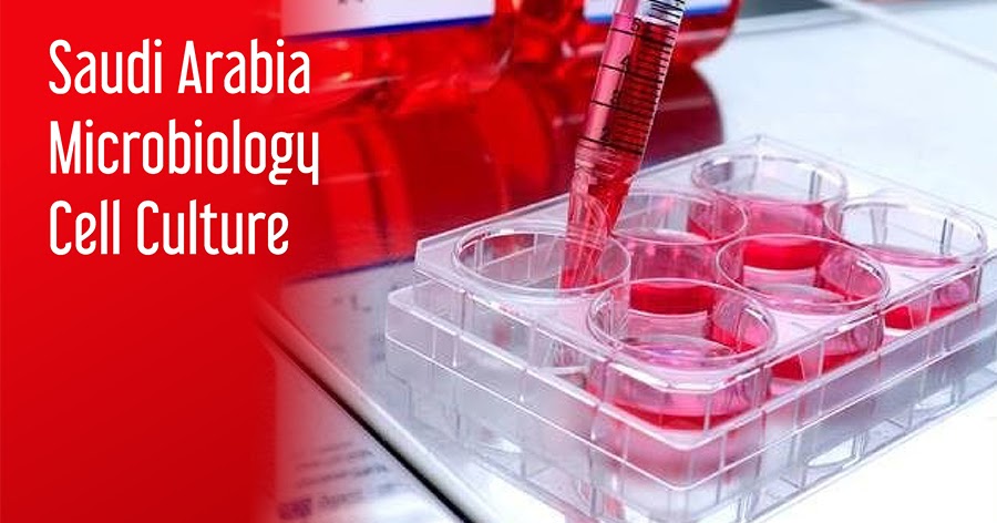 Surging Prevalence of Infectious Diseases Supporting Saudi Arabia Microbiology Cell Culture Market