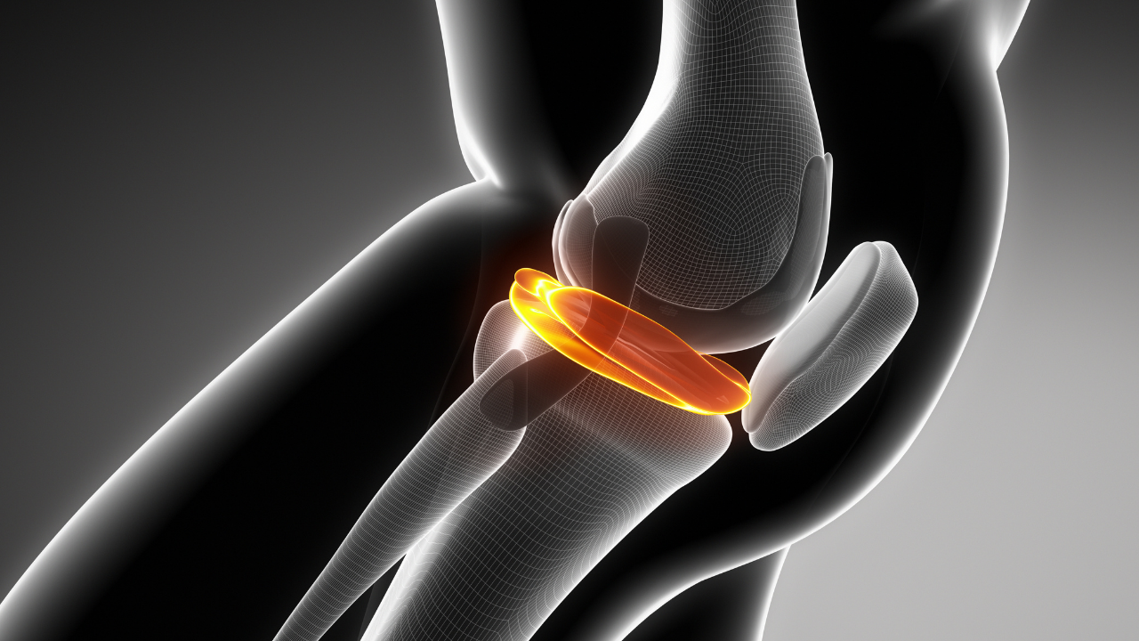 [RESEARCH] Is Knee Noise a Problem? Modern Manual Therapy Blog