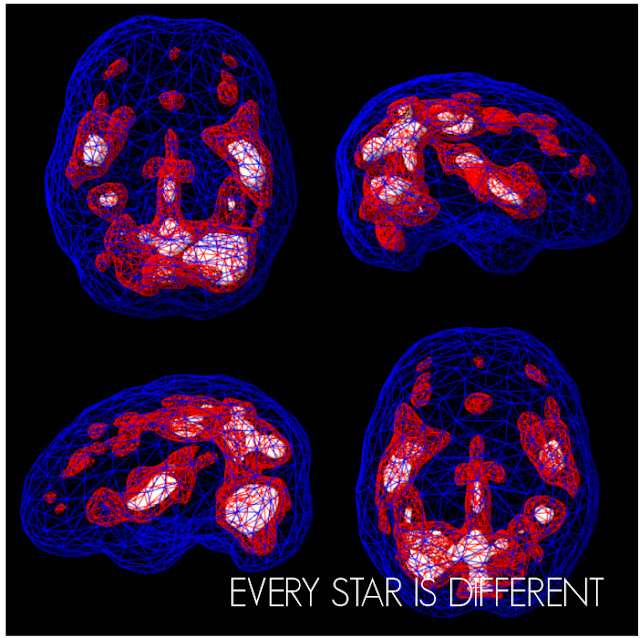 Amen Clinic Brain Scan Results Part 2