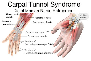 Anatomy of Carpal Tunnel Syndrome