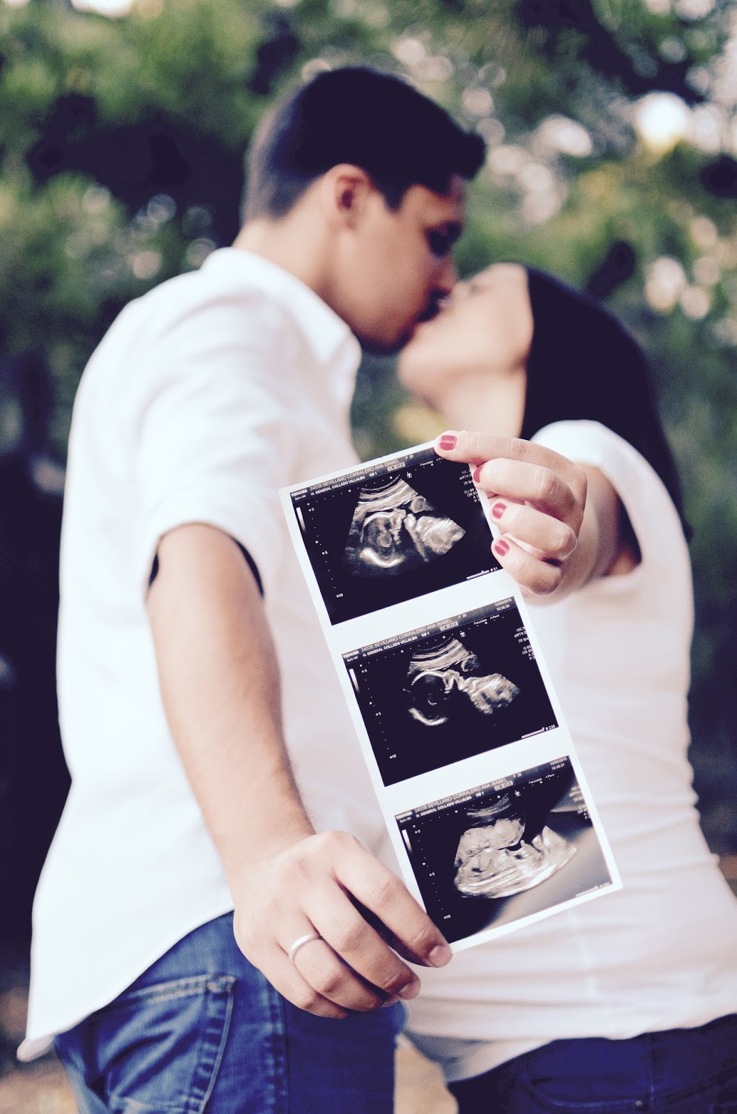 A&N: una sesión de fotos de embarazo en medio del bosque | Sin sapos ni