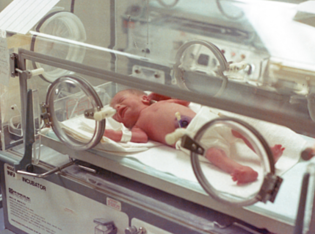 bayi yang membutuhkan inkubator