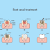 Low Cost Root Canal Treatment in Jamaica